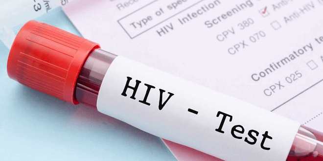 Testing Week Europea per HIV, HCV e sifilide: dal 22 al 29 novembre i test saranno gratuiti